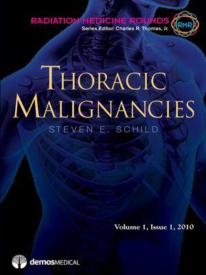 cover image of Thoracic Malignancies